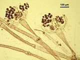 6 – Dettaglio dei carposporofiti avvolti dai filamenti involucrali ricurvi